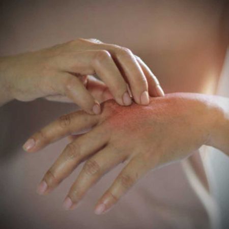 Picture for category Eczema Care Products 